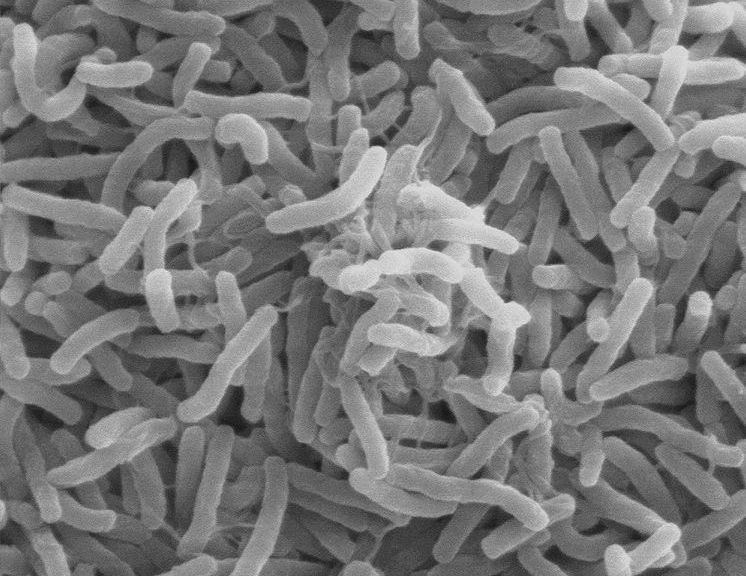 Bakterie Vibrio Cholerae